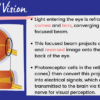 Vision Problems/Eye Disorders - Image 4